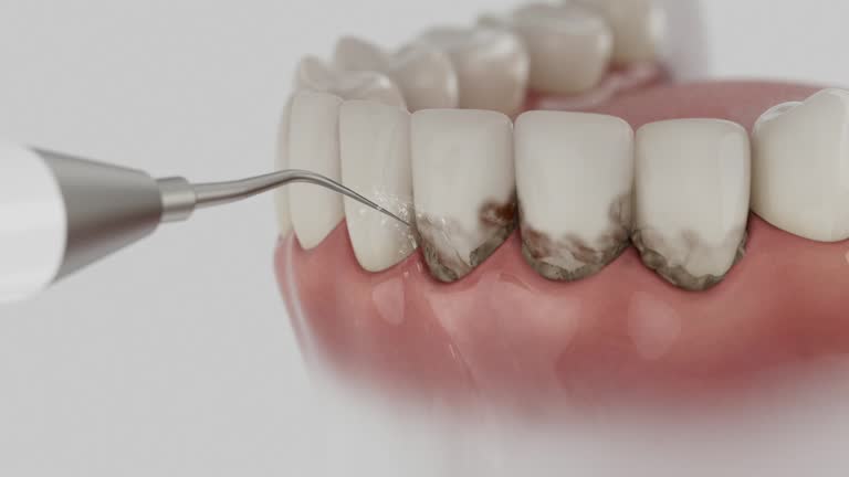 Trusted Tooth Extraction service in Brookville, OH - Dentist Open Now